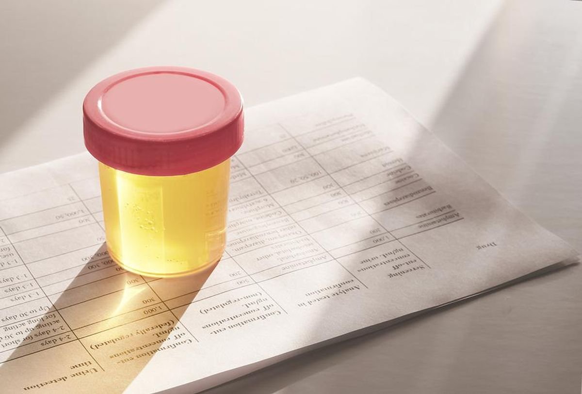 Why You Shouldn’t Take A Drug Test If You Know You’ll Fail #Shouldnt #Drug #Test #Youll #Fail